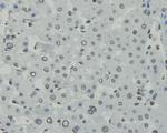 CCDC47 Antibody in Immunohistochemistry (Paraffin) (IHC (P))