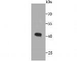 CCDC47 Antibody in Western Blot (WB)