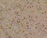 PIEZO1 Antibody in Immunohistochemistry (Paraffin) (IHC (P))