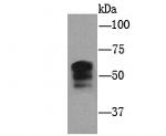 PIEZO1 Antibody in Western Blot (WB)