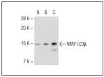 LDHA Antibody in Immunohistochemistry (Paraffin) (IHC (P))