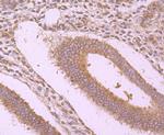 WSCD2 Antibody in Immunohistochemistry (Paraffin) (IHC (P))