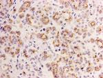 ID2 Antibody in Immunohistochemistry (Paraffin) (IHC (P))