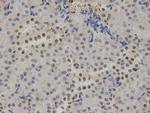 ATRX Antibody in Immunohistochemistry (Paraffin) (IHC (P))