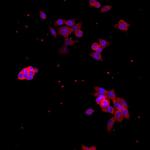 CDK2 Antibody in Immunocytochemistry (ICC/IF)