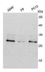 CDK2 Antibody in Western Blot (WB)