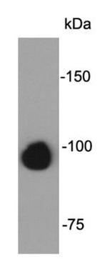 FGFR2 Antibody in Western Blot (WB)