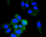 ALDH2 Antibody in Immunocytochemistry (ICC/IF)