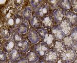 ALDH2 Antibody in Immunohistochemistry (Paraffin) (IHC (P))