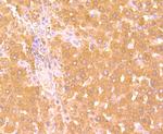 Haptoglobin Antibody in Immunohistochemistry (Paraffin) (IHC (P))