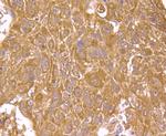 Haptoglobin Antibody in Immunohistochemistry (Paraffin) (IHC (P))