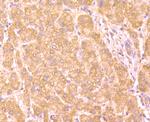 Haptoglobin Antibody in Immunohistochemistry (Paraffin) (IHC (P))