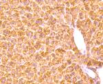 Haptoglobin Antibody in Immunohistochemistry (Paraffin) (IHC (P))