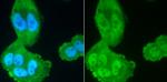 PP2A alpha/beta Antibody in Immunocytochemistry (ICC/IF)