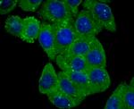 BLCAP Antibody in Immunocytochemistry (ICC/IF)