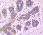 BLCAP Antibody in Immunohistochemistry (Paraffin) (IHC (P))