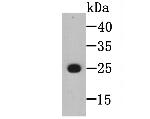 BLCAP Antibody in Western Blot (WB)