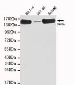 SMC1 Antibody in Western Blot (WB)