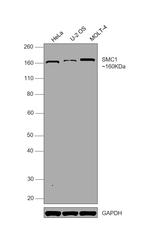 SMC1 Antibody in Western Blot (WB)