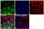 HDAC4 Antibody in Immunocytochemistry (ICC/IF)