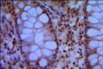 SMC1 Antibody in Immunohistochemistry (Paraffin) (IHC (P))