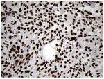 SMC1 Antibody in Immunohistochemistry (Paraffin) (IHC (P))