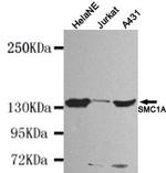 SMC1 Antibody in Western Blot (WB)