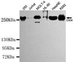 CHD4 Antibody in Western Blot (WB)