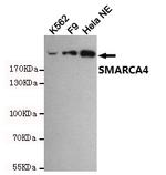 BRG1 Antibody in Western Blot (WB)