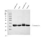 TPM1 Antibody in Western Blot (WB)