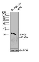 S100B Antibody in Western Blot (WB)