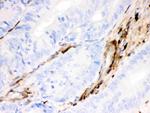 Gelsolin Antibody in Immunohistochemistry (Paraffin) (IHC (P))