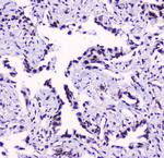 SMC3 Antibody in Immunohistochemistry (Paraffin) (IHC (P))