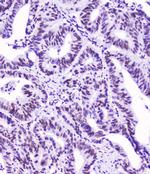 SMC3 Antibody in Immunohistochemistry (Paraffin) (IHC (P))