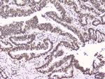 RbAp48 Antibody in Immunohistochemistry (Paraffin) (IHC (P))