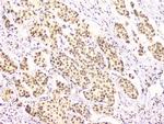 RbAp48 Antibody in Immunohistochemistry (Paraffin) (IHC (P))