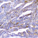 CD2AP Antibody in Immunohistochemistry (Paraffin) (IHC (P))