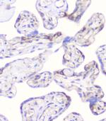 CD2AP Antibody in Immunohistochemistry (Paraffin) (IHC (P))