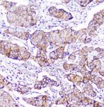 CD2AP Antibody in Immunohistochemistry (Paraffin) (IHC (P))