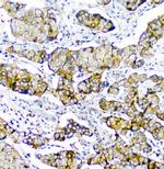 CD2AP Antibody in Immunohistochemistry (Paraffin) (IHC (P))