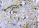 CD2AP Antibody in Immunohistochemistry (Paraffin) (IHC (P))