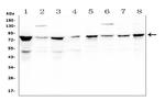 CD2AP Antibody in Western Blot (WB)