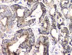 Fumarase Antibody in Immunohistochemistry (Paraffin) (IHC (P))