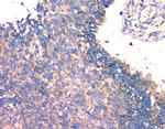 Fumarase Antibody in Immunohistochemistry (Paraffin) (IHC (P))