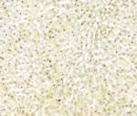 Fumarase Antibody in Immunohistochemistry (Paraffin) (IHC (P))