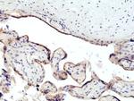 CD71 (Transferrin Receptor) Antibody in Immunohistochemistry (Paraffin) (IHC (P))