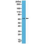 Estrogen Receptor alpha Antibody in Western Blot (WB)