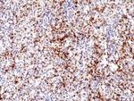 CD61 (Integrin beta 3) Antibody in Immunohistochemistry (Paraffin) (IHC (P))