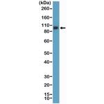 CD61 (Integrin beta 3) Antibody in Western Blot (WB)