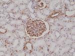 Vimentin Antibody in Immunohistochemistry (Paraffin) (IHC (P))